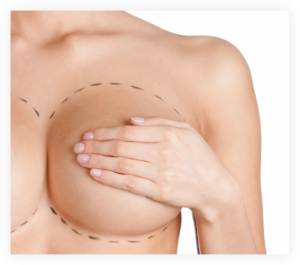 Breast Implant Pain due to Capsular Constracture