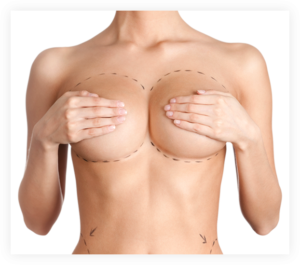 Capsular Contracture without surgery