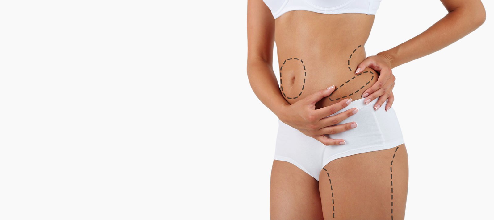 Liposuction Fibrosis Treatment