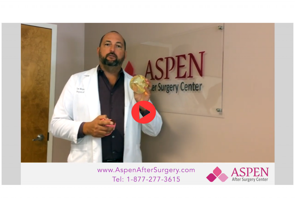 Does massage help or prevent Capsular Contracture?