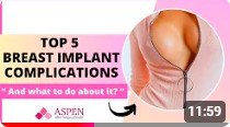 TOP 5 BREAST IMPLANT COMPLICATIONS